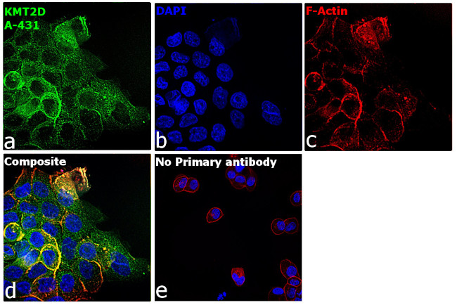 KMT2D Antibody in Immunocytochemistry (ICC/IF)