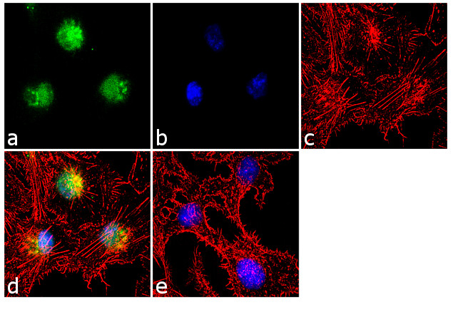 KMT2D Antibody in Immunocytochemistry (ICC/IF)