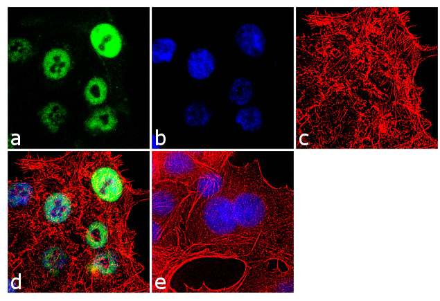 RNF20 Antibody in Immunocytochemistry (ICC/IF)