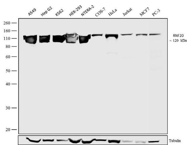 RNF20 Antibody in Western Blot (WB)