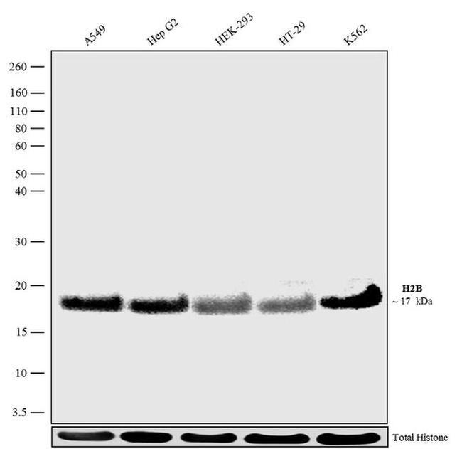 Histone H2B Antibody in Western Blot (WB)