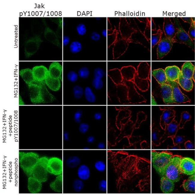 Phospho-JAK2 (Tyr1007, Tyr1008) Antibody in Immunocytochemistry (ICC/IF)