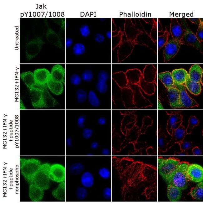 Phospho-JAK2 (Tyr1007, Tyr1008) Antibody