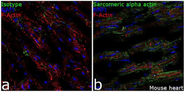 alpha Actinin 2 Antibody in Immunohistochemistry (Frozen) (IHC (F))