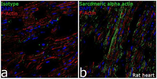 alpha Actinin 2 Antibody in Immunohistochemistry (Frozen) (IHC (F))