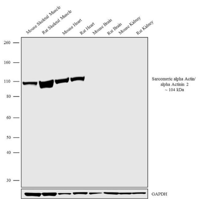 alpha Actinin 2 Antibody