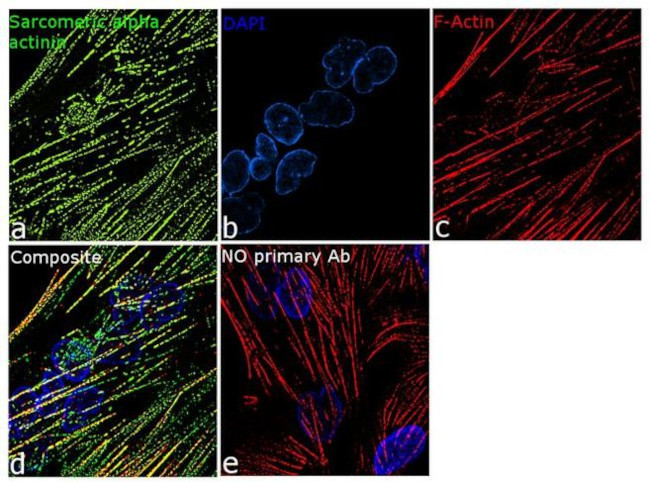 alpha Actinin 2 Antibody in Immunocytochemistry (ICC/IF)