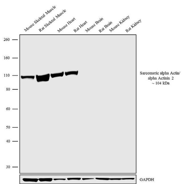 alpha Actinin 2 Antibody in Western Blot (WB)