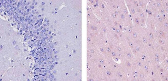 Sca-1 Antibody in Immunohistochemistry (Paraffin) (IHC (P))