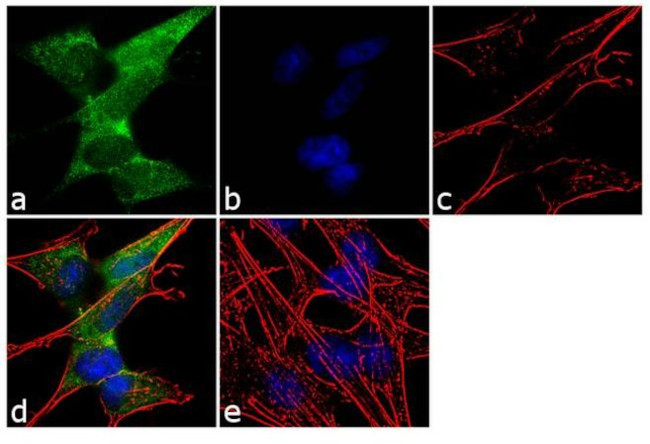 Somatostatin Antibody in Immunocytochemistry (ICC/IF)