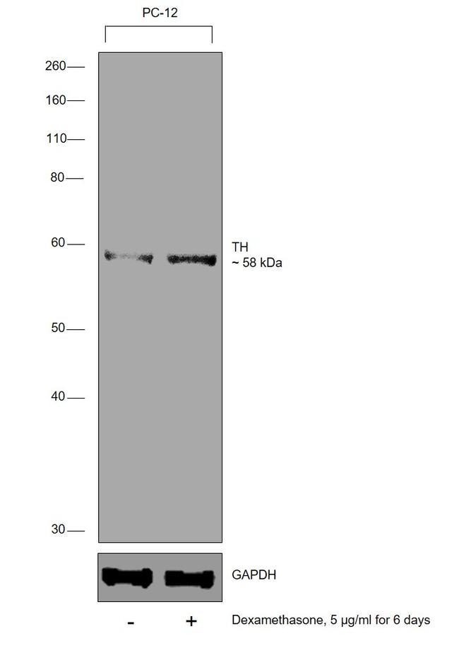 Tyrosine Hydroxylase Antibody