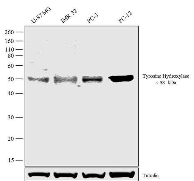 Tyrosine Hydroxylase Antibody in Western Blot (WB)