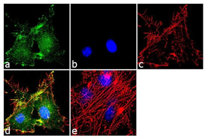 GLT-1 Antibody in Immunocytochemistry (ICC/IF)