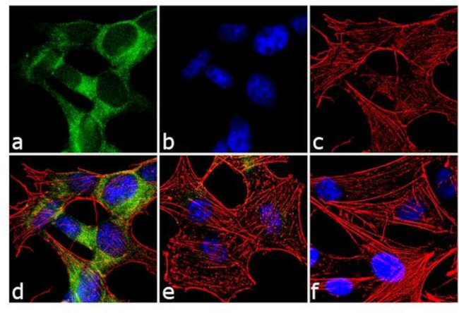 PSD93 Antibody in Immunocytochemistry (ICC/IF)