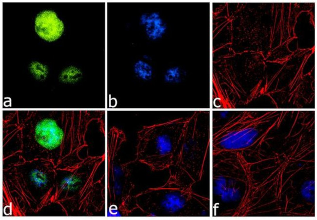 EVI1 Antibody in Immunocytochemistry (ICC/IF)