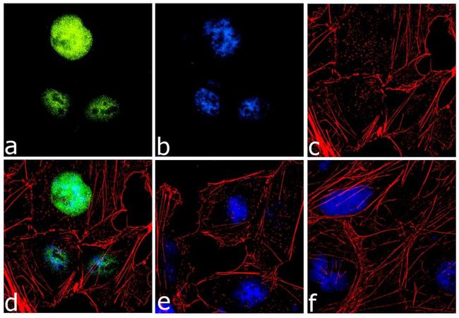 EVI1 Antibody