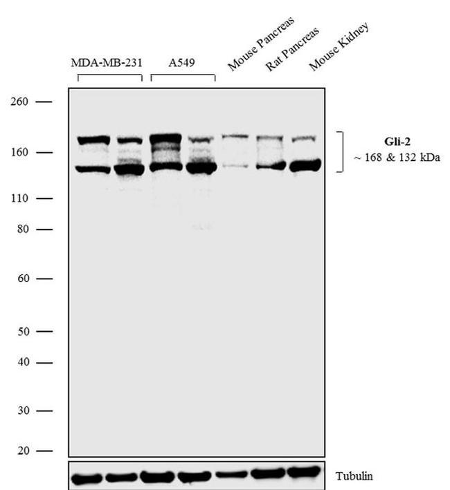 GLI2 Antibody in Western Blot (WB)