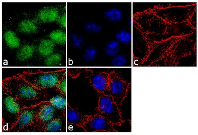 SOX9 Antibody in Immunocytochemistry (ICC/IF)