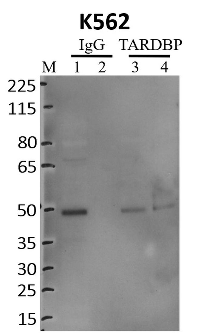 TDP-43 Antibody in RNA Immunoprecipitation (RIP)