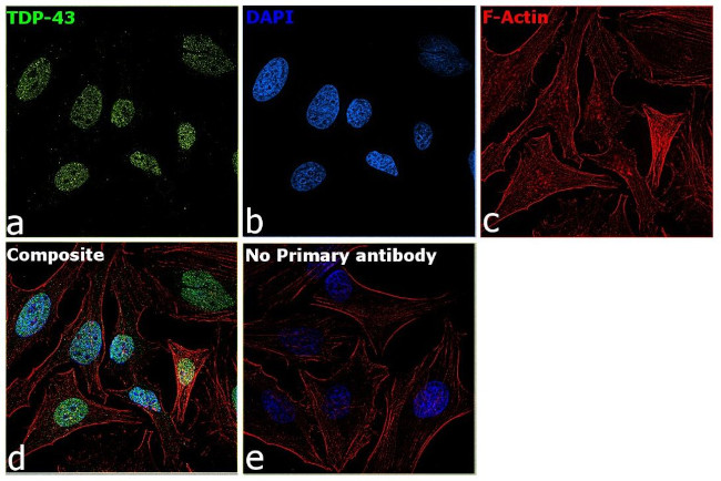 TDP-43 Antibody in Immunocytochemistry (ICC/IF)
