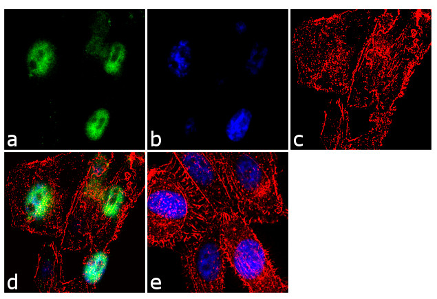 MECP2 Antibody in Immunocytochemistry (ICC/IF)