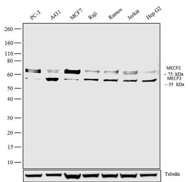 MECP2 Antibody in Western Blot (WB)