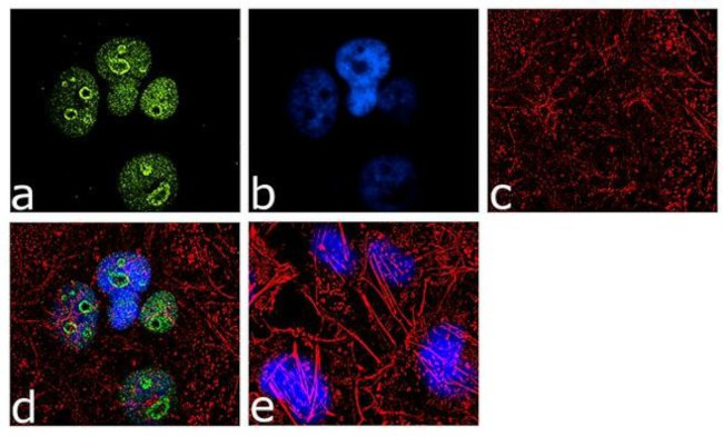 NSUN2 Antibody in Immunocytochemistry (ICC/IF)