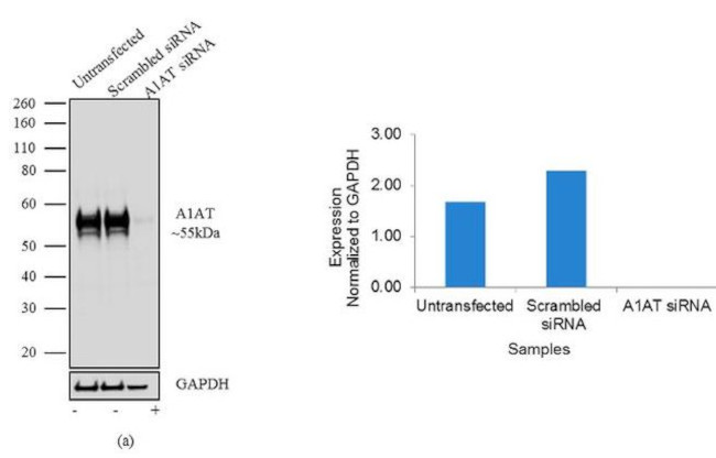 alpha-1 Antitrypsin Antibody