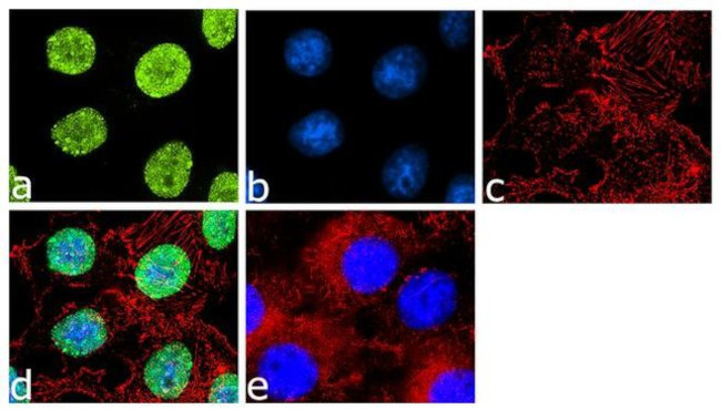 TBX3 Antibody in Immunocytochemistry (ICC/IF)