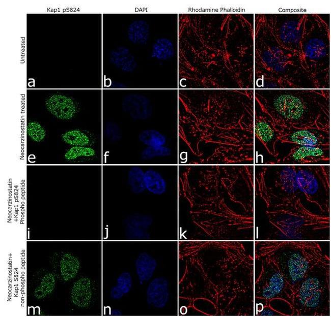 Phospho-TRIM28 (Ser824) Antibody