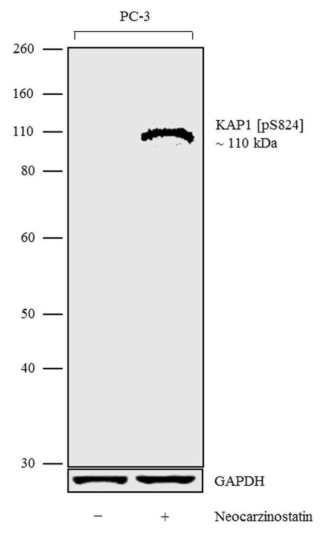 Phospho-TRIM28 (Ser824) Antibody in Western Blot (WB)