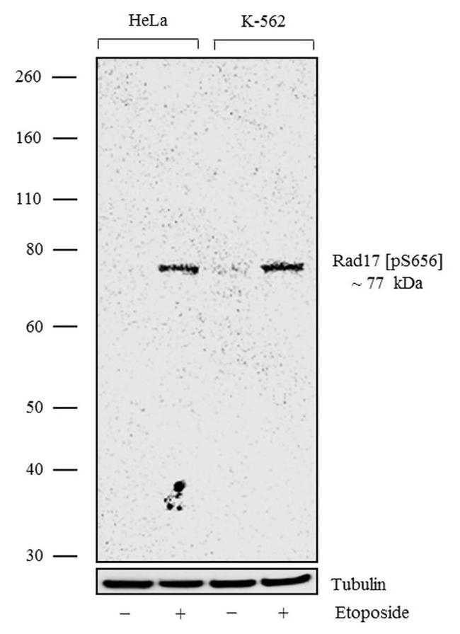 Phospho-RAD17 (Ser656) Antibody in Western Blot (WB)