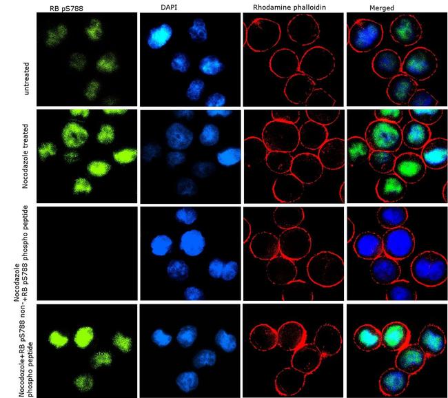 Phospho-Rb (Ser788) Antibody