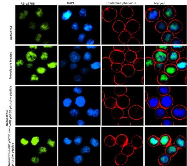 Phospho-Rb (Ser788) Antibody in Immunocytochemistry (ICC/IF)