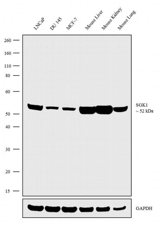 SGK1 Antibody in Western Blot (WB)