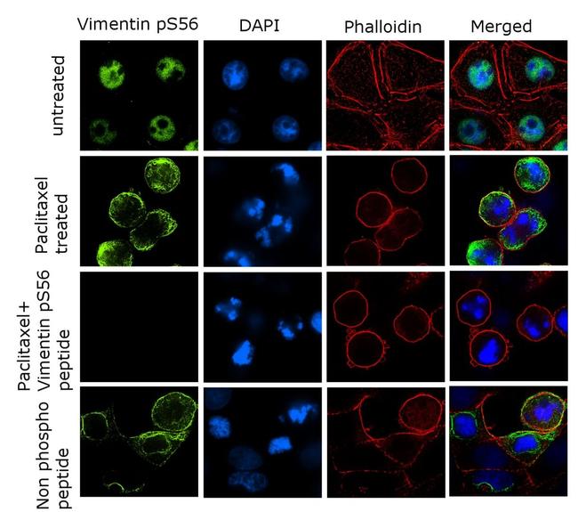 Phospho-Vimentin (Ser56) Antibody