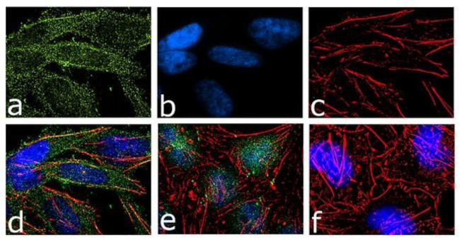 B-Raf Antibody in Immunocytochemistry (ICC/IF)