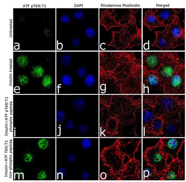 Phospho-ATF2 (Tyr69, Thr71) Antibody