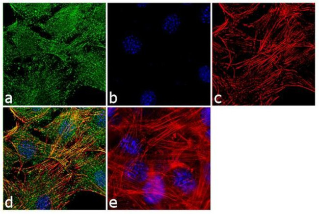 Laminin-211 Antibody in Immunocytochemistry (ICC/IF)