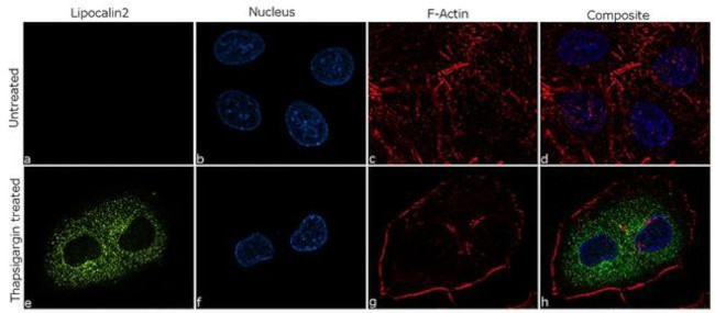 NGAL Antibody in Immunocytochemistry (ICC/IF)