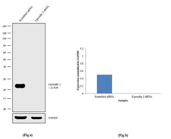 NGAL Antibody in Western Blot (WB)