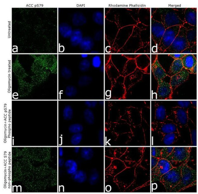 Phospho-Acetyl-CoA Carboxylase (Ser79) Antibody in Immunocytochemistry (ICC/IF)