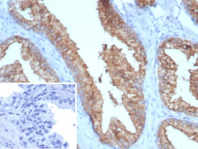 TMPRSS2 (Transmembrane Serine Protease 2) Antibody in Immunohistochemistry (Paraffin) (IHC (P))