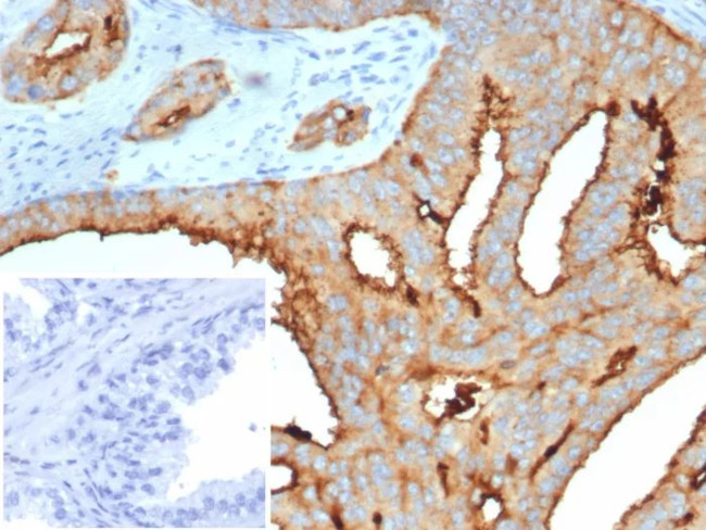 TMPRSS2 (Transmembrane Serine Protease 2) Antibody in Immunohistochemistry (Paraffin) (IHC (P))