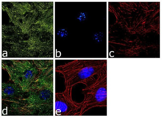 Laminin-221 Antibody in Immunocytochemistry (ICC/IF)