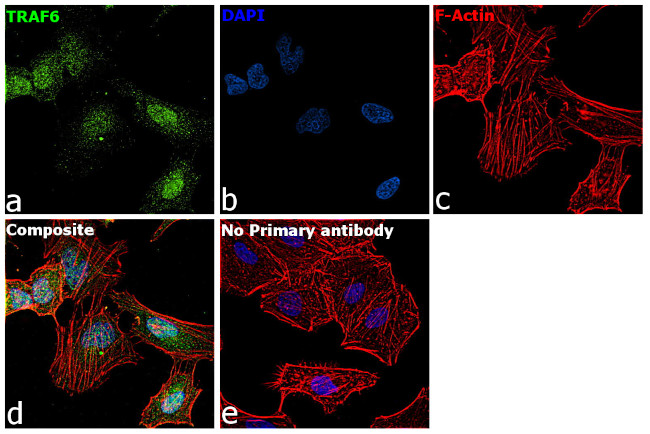 TRAF6 Antibody in Immunocytochemistry (ICC/IF)