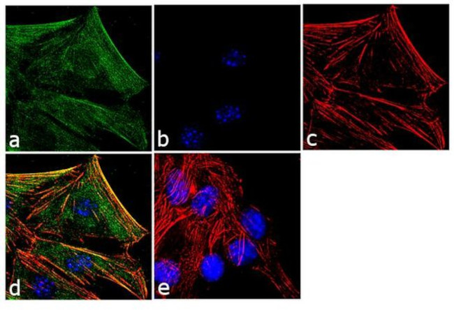 Laminin-213 Antibody in Immunocytochemistry (ICC/IF)