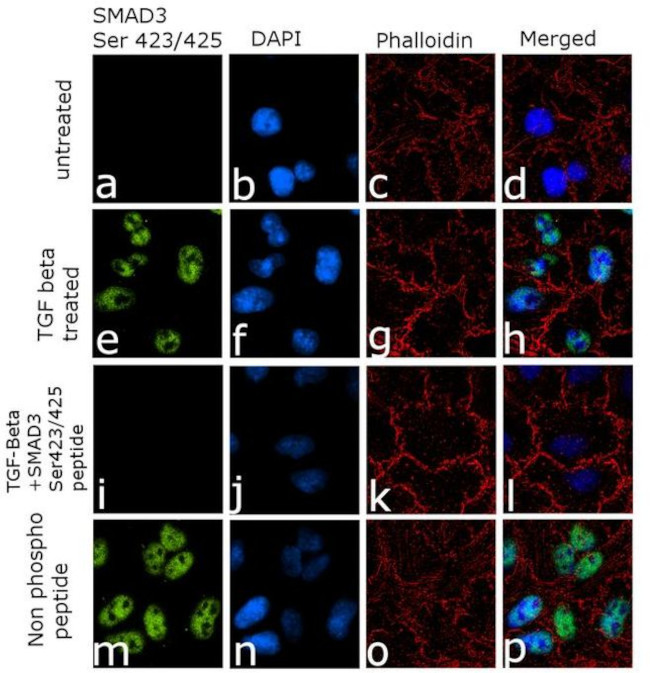 Phospho-SMAD3 (Ser423, Ser425) Antibody in Immunocytochemistry (ICC/IF)