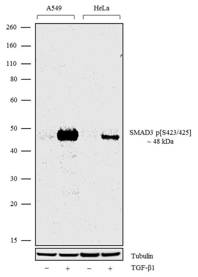 Phospho-SMAD3 (Ser423, Ser425) Antibody in Western Blot (WB)