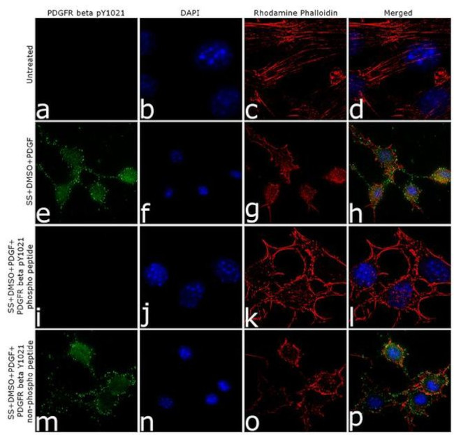 Phospho-PDGFRB (Tyr1021) Antibody in Immunocytochemistry (ICC/IF)